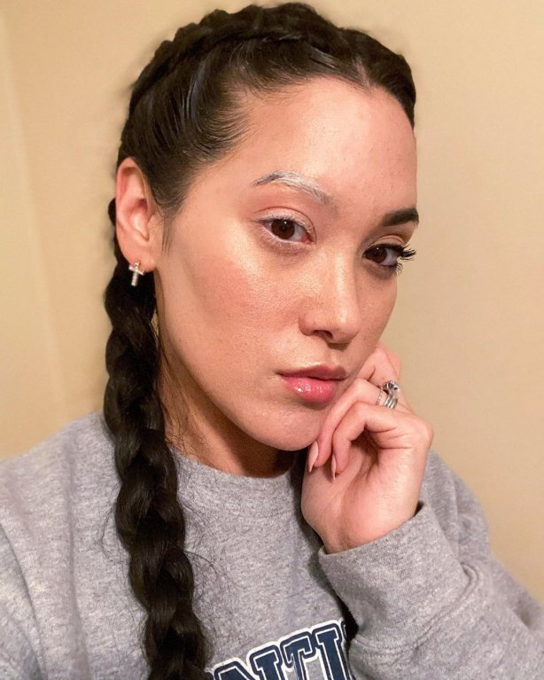 Ženu postihlo vitiligo jen na polovinu obličeje Ženu postihlo vitiligo jen na polovinu obličeje