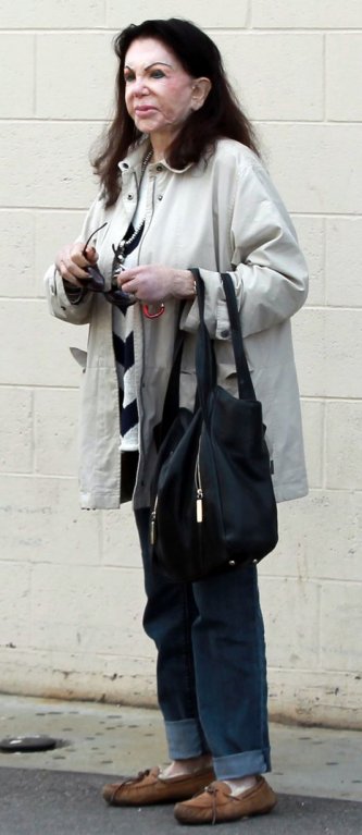 Jackie Stallone (92), i takhle to může dopadnout, když to přeženete s plastikami - Obrázek 3 Jackie Stallone (92), i takhle to může dopadnout, když to přeženete s plastikami - Obrázek 3