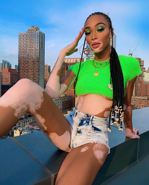 Winnie Harlow (Kanada) Winnie Harlow (Kanada)