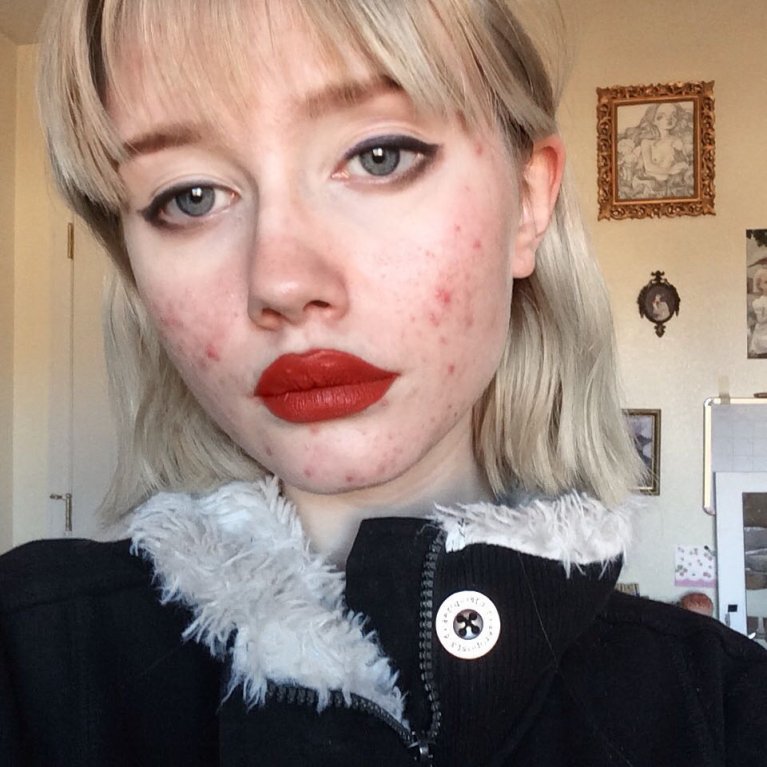 Hailey Wait - Dívka s akné 3 Hailey Wait - Dívka s akné 3