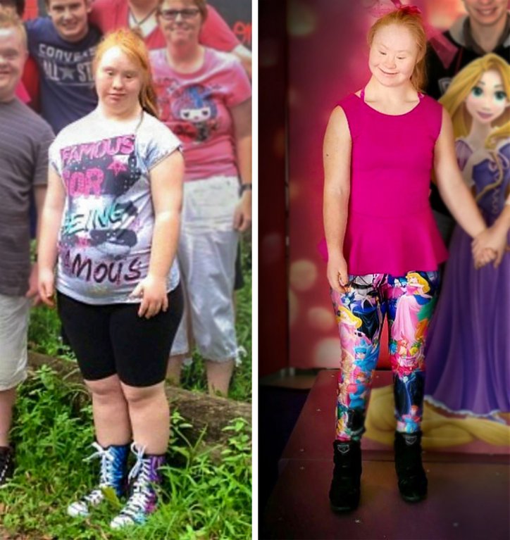 Madeline Stuart 1 Madeline Stuart 1