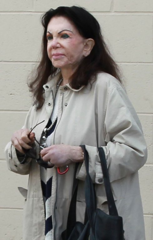Jackie Stallone (92), i takhle to může dopadnout, když to přeženete s plastikami - Obrázek 5 Jackie Stallone (92), i takhle to může dopadnout, když to přeženete s plastikami - Obrázek 5