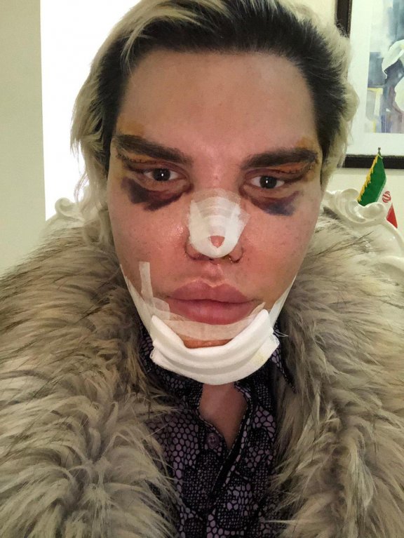 Rodrigo Alves se znovu proměnil 5 Rodrigo Alves se znovu proměnil 5
