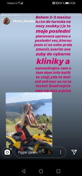 Daisy Lee plánuje nové zuby. Daisy Lee plánuje nové zuby.
