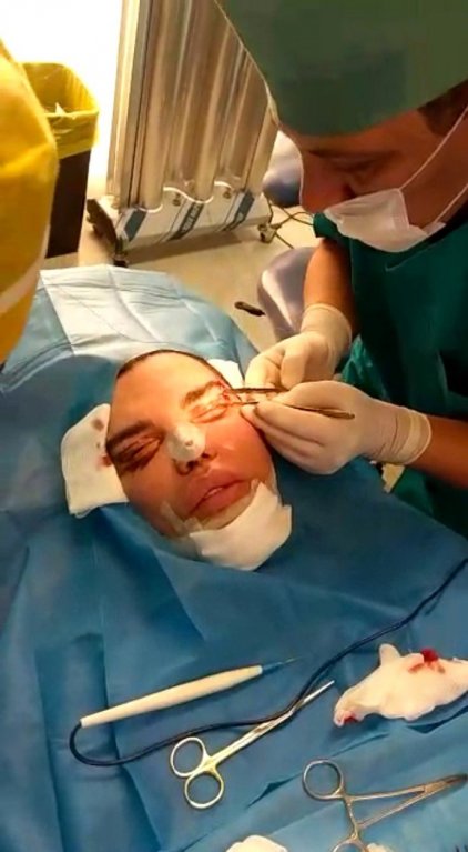 Rodrigo Alves se znovu proměnil 1 Rodrigo Alves se znovu proměnil 1