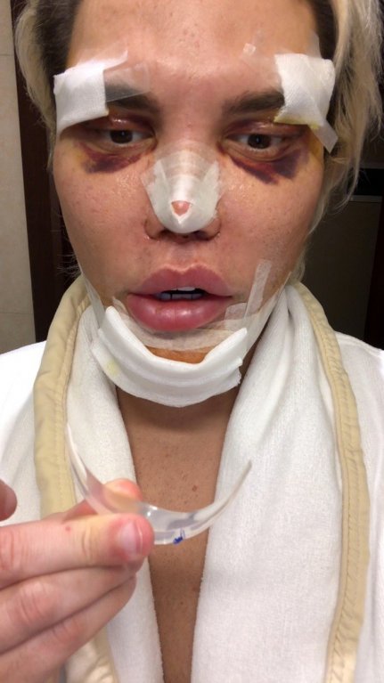 Rodrigo Alves se znovu proměnil 2 Rodrigo Alves se znovu proměnil 2