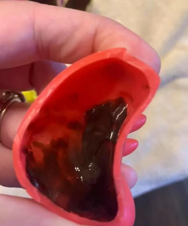 Plesnivé dětské hračky určené do vody 2 Plesnivé dětské hračky určené do vody 2