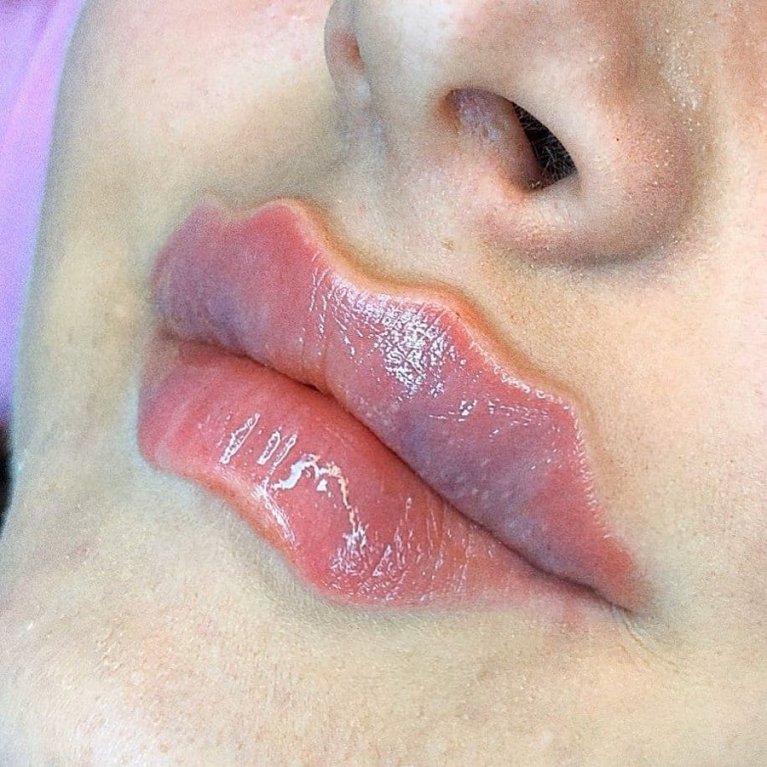 Nový nebezpečný trend zakroucených rtů Nový nebezpečný trend zakroucených rtů