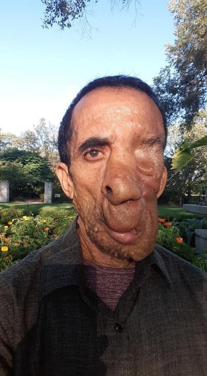 Ashok Shresth (60) Ashok Shresth (60)