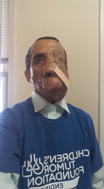 Ashok Shresth (60) Ashok Shresth (60)