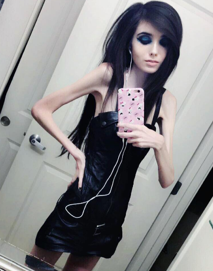 Anorexií prý netrpí. Anorexií prý netrpí.