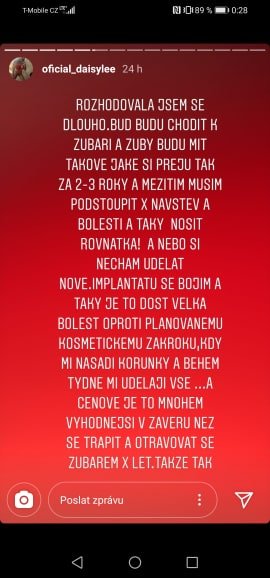Daisy Lee kvůli novým zubům plánuje cestu do Turecka. Daisy Lee kvůli novým zubům plánuje cestu do Turecka.