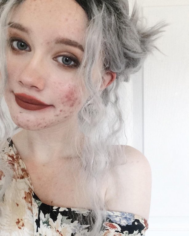 Hailey Wait - Dívka s akné 8 Hailey Wait - Dívka s akné 8