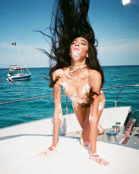 Winnie Harlow (Kanada) Winnie Harlow (Kanada)