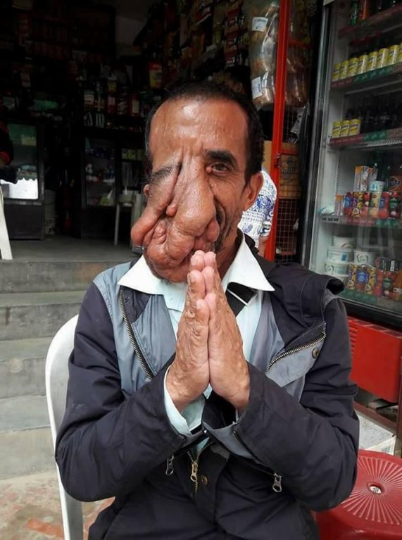 Ashok Shresth (60) Ashok Shresth (60)