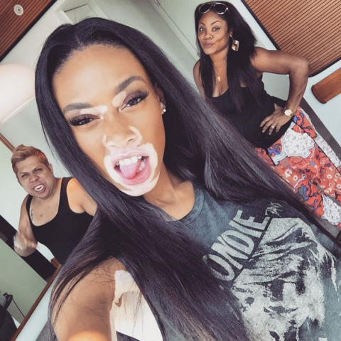 Winnie Harlow Winnie Harlow